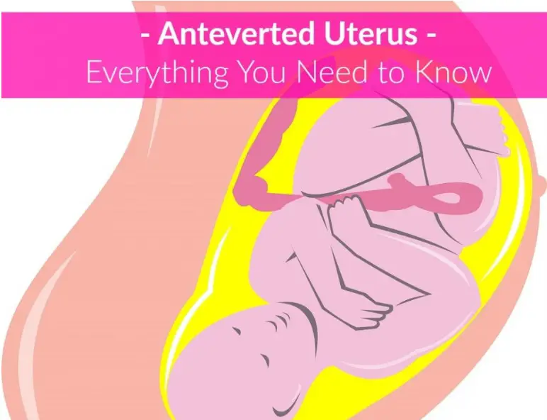 Anteverted Uterus Everything You Need To Know The Healthy Apron