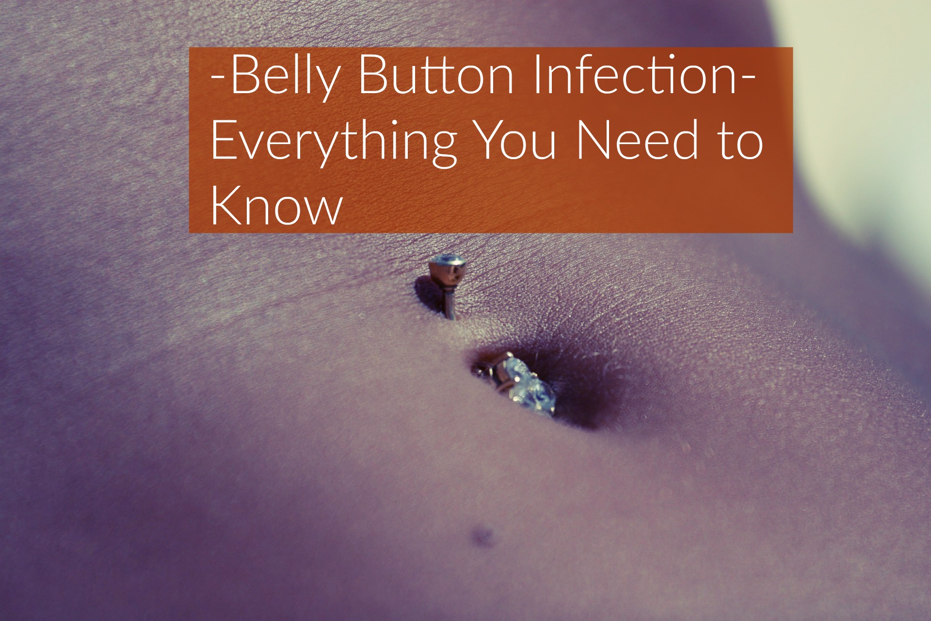 Belly Button Infection Causes Symptoms Treatment 