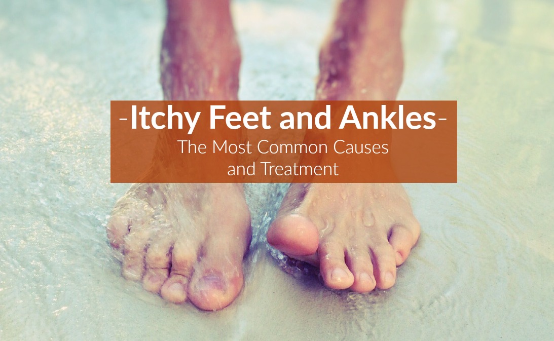 Itchy Feet and Ankles (Causes, Symptoms, Treatment)