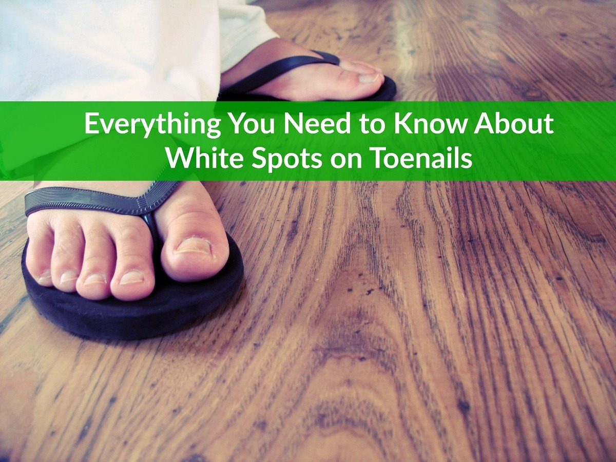 white-spots-on-toenails-everything-you-need-to-know-the-healthy-apron