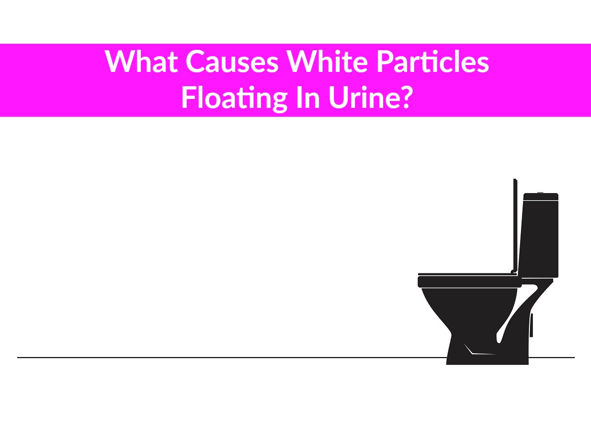 White Stuff In Urine Female | Bruin Blog