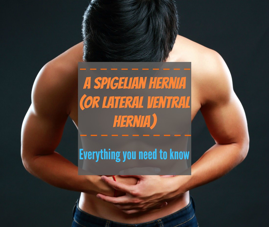 A Spigelian Hernia Or Lateral Ventral Hernia Everything You Need To