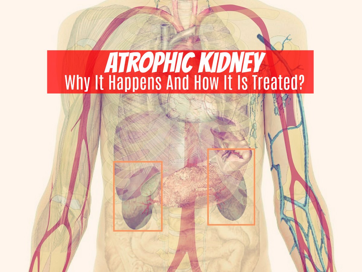 Atrophic Kidney - Why It Happens And How It Is Treated