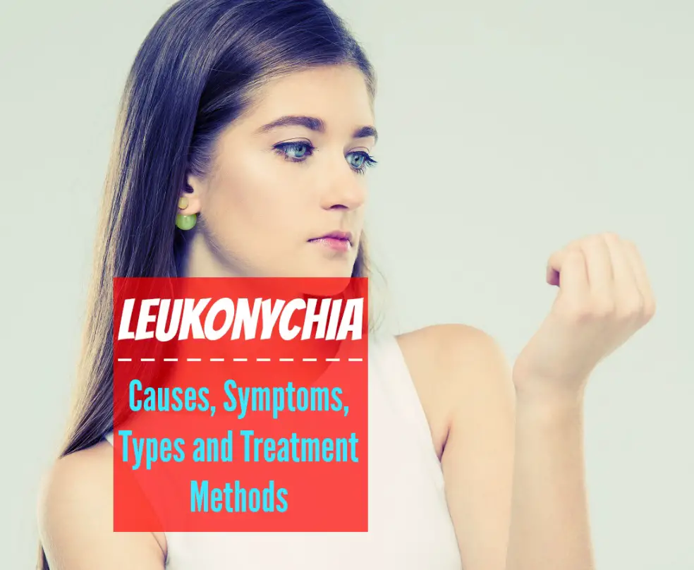 Leukonychia - Causes Symptoms Types and Treatment Methods