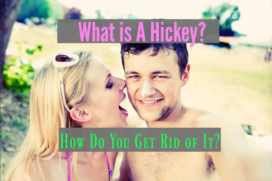 What is A Hickey and How Do You Get Rid of It